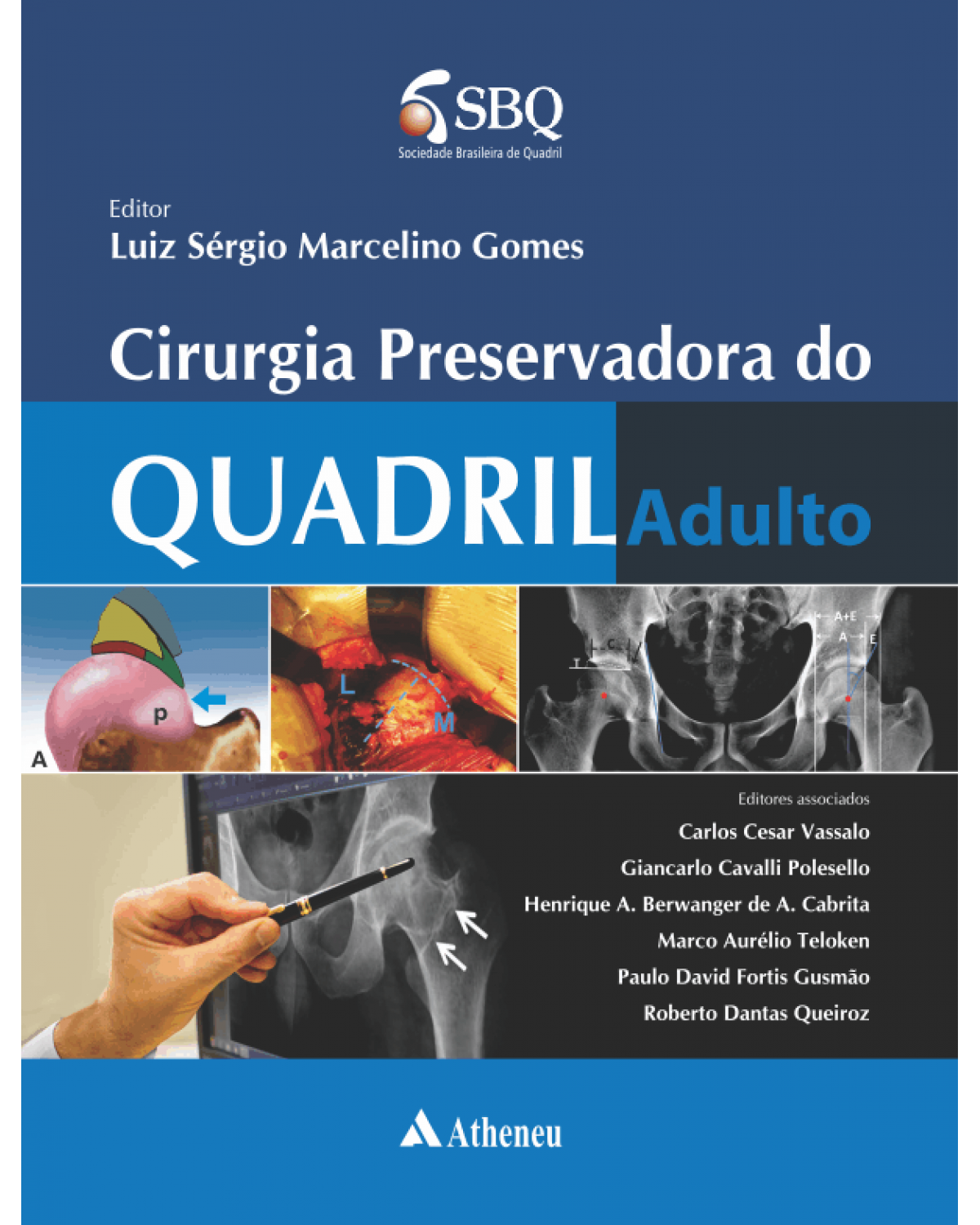 Cirurgia preservadora do quadril adulto - 1ª Edição | 2015