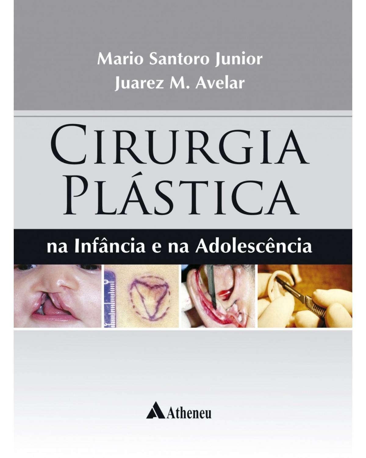 Cirurgia plástica - na infância e na adolescência - 1ª Edição | 2018