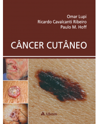 Câncer cutâneo - 1ª Edição | 2018