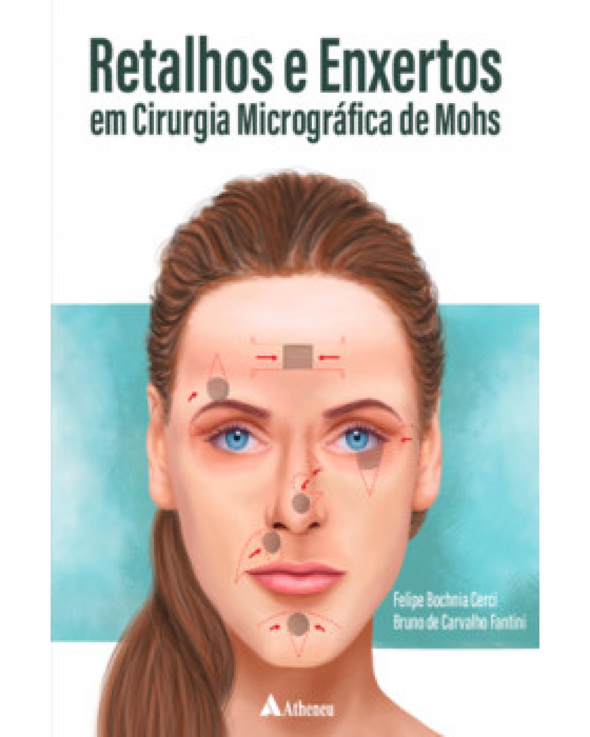 Retalhos e enxertos em cirurgia micrográfica de Mohs - 1ª Edição | 2022