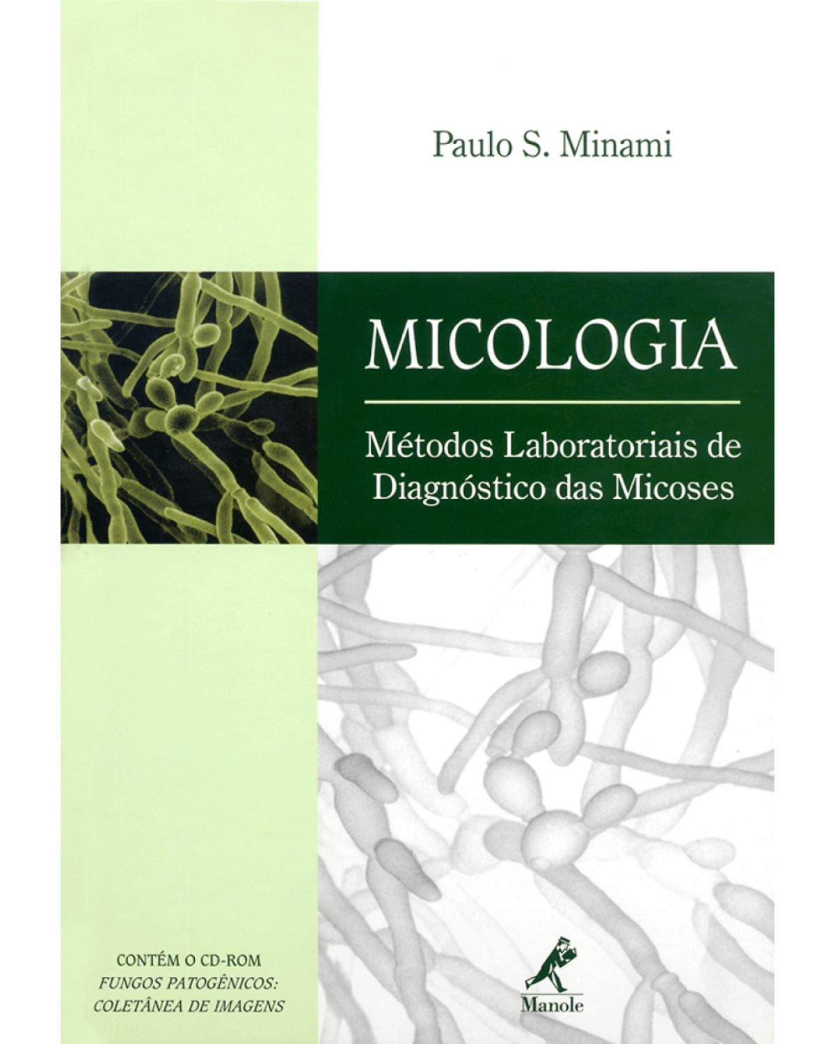 Micologia - Métodos laboratoriais de diagnóstico das micoses - 1ª Edição | 2003