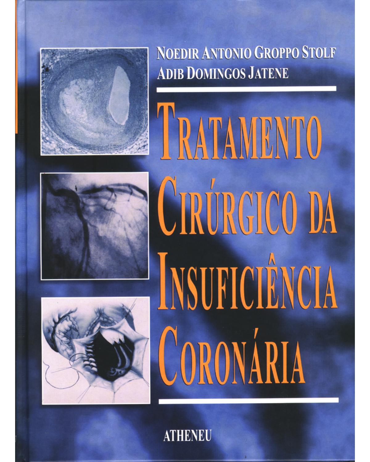 Tratamento cirúrgico da insuficiência coronária - 1ª Edição | 2001