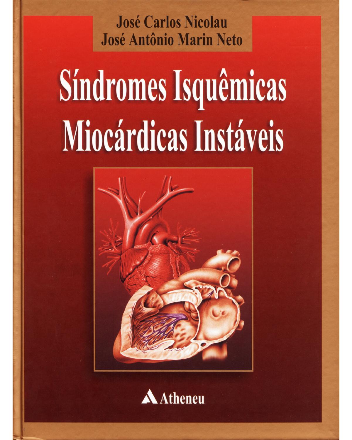Síndrome isquêmicas miocárdicas instáveis - 1ª Edição | 2001