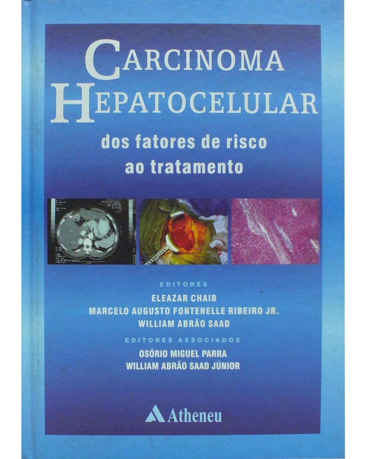 Carcinoma hepatocelular: Dos fatores de risco ao tratamento - 1ª Edição | 2004