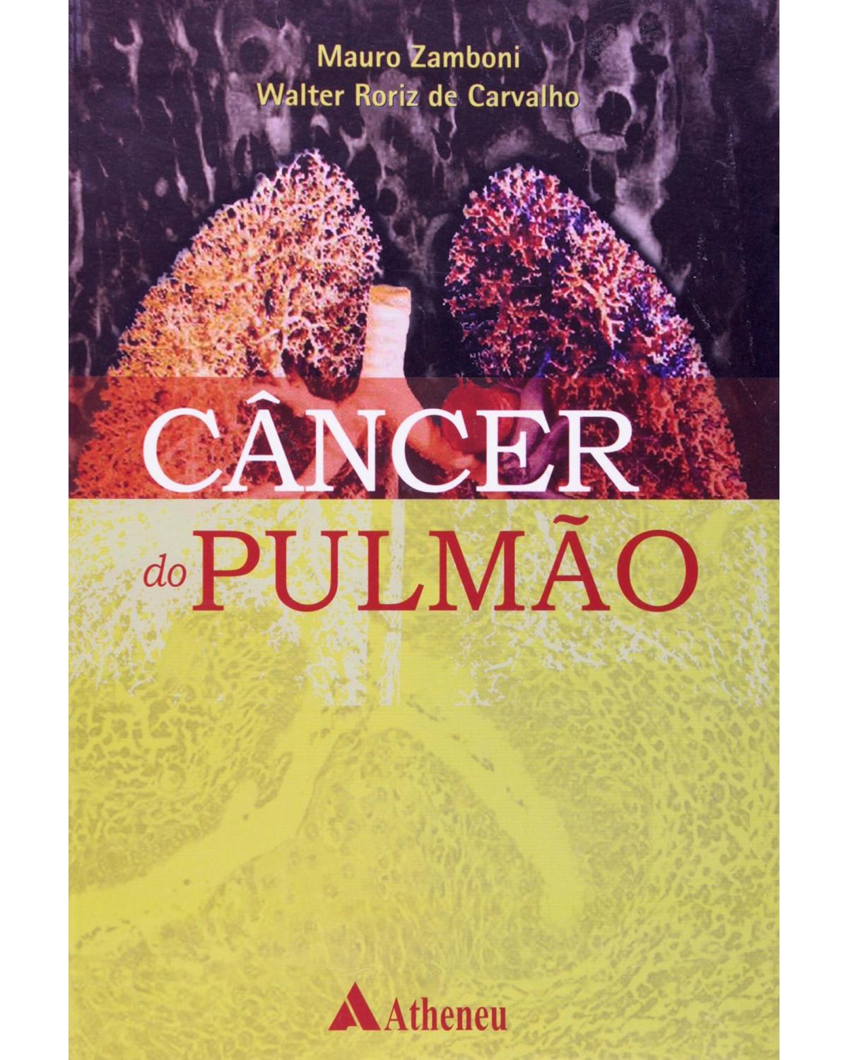 Câncer do pulmão - 1ª Edição