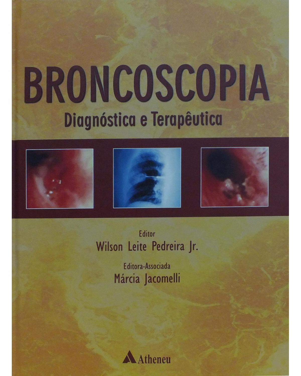 Broncoscopia: Diagnóstica e terapêutica - 1ª Edição | 2005