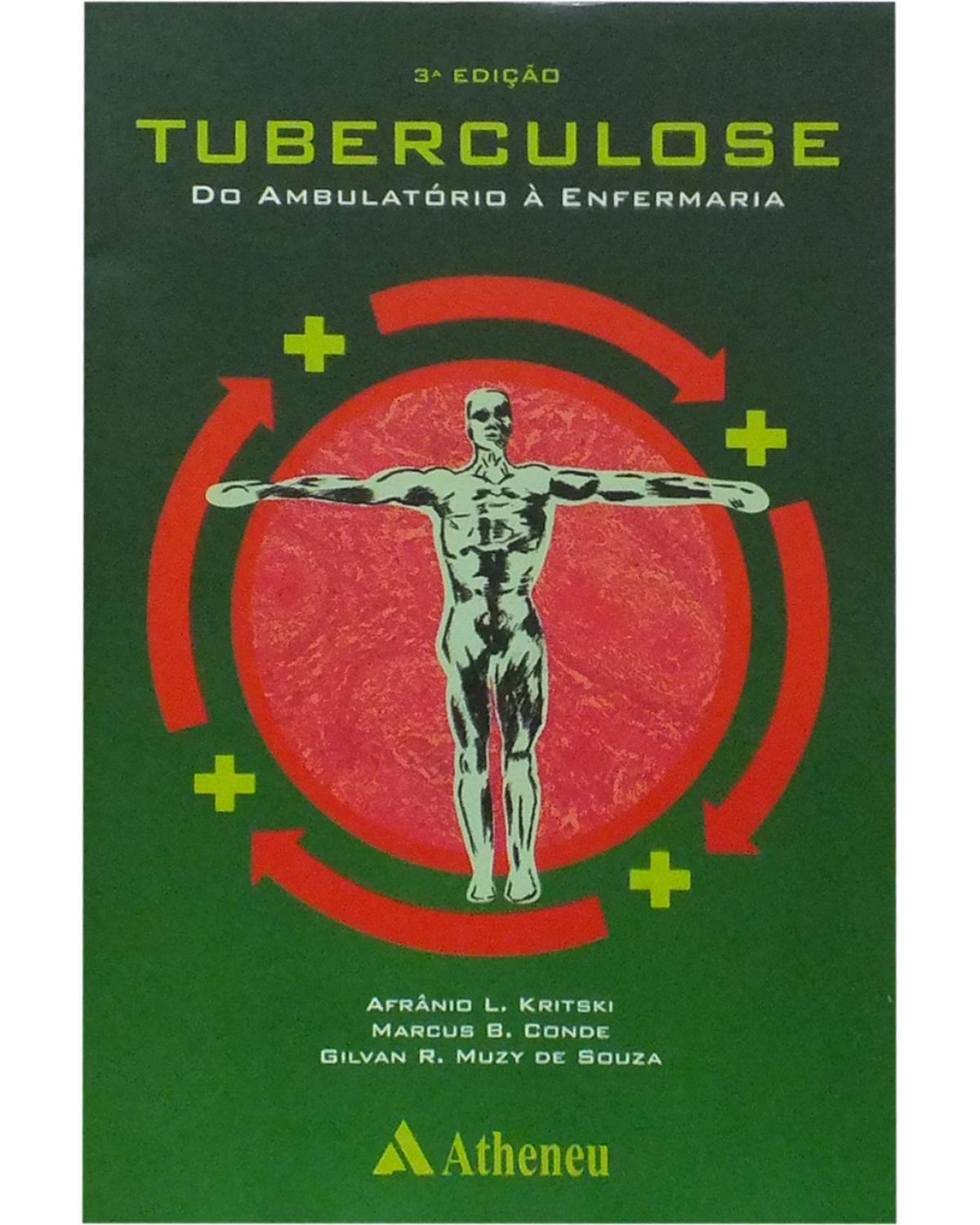 Tuberculose do ambulatório à enfermaria - 3ª Edição | 2005