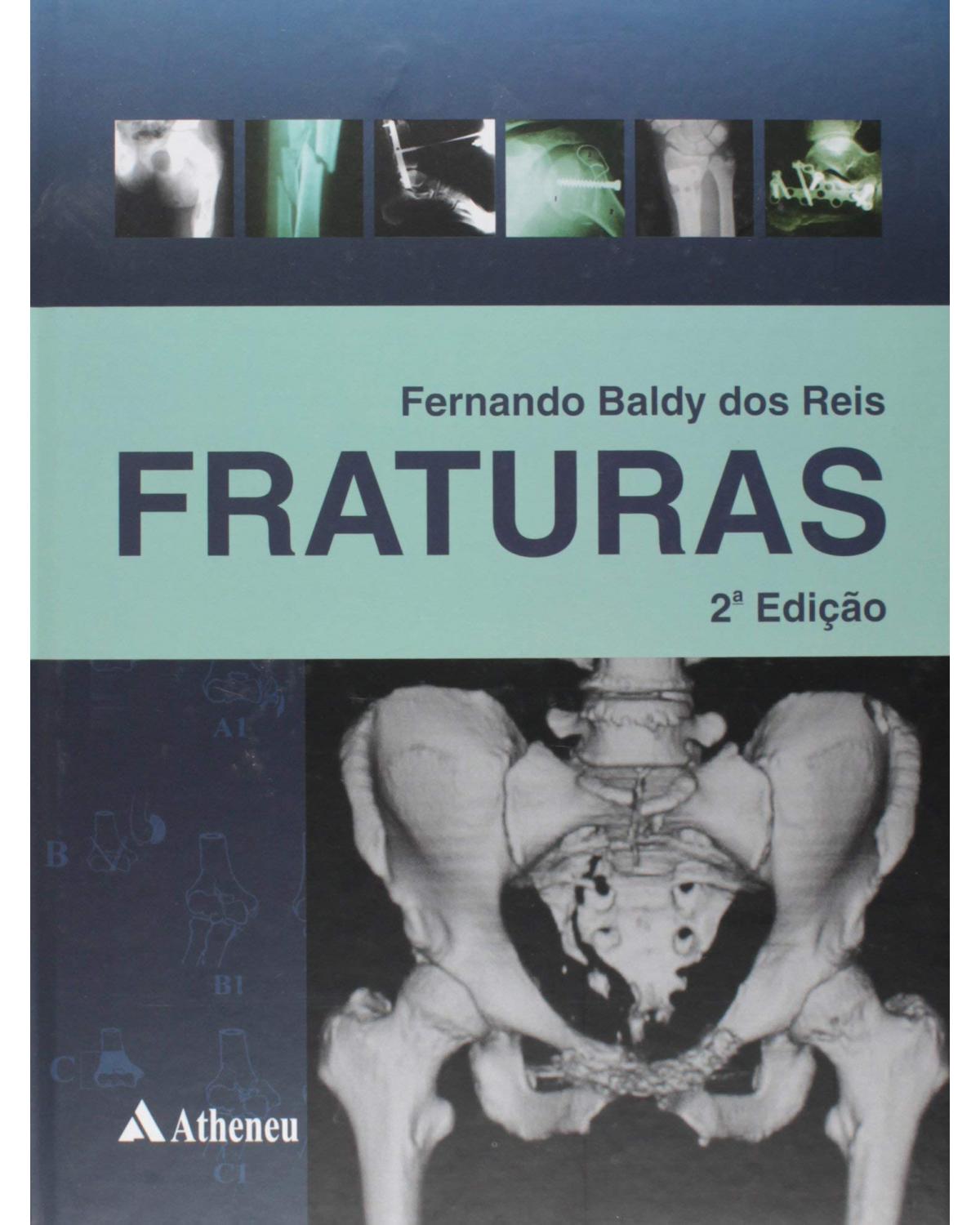 Fraturas - 2ª Edição | 2005