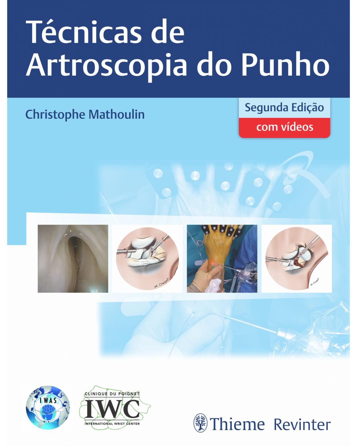 Técnicas de artroscopia do punho - 2ª Edição | 2021