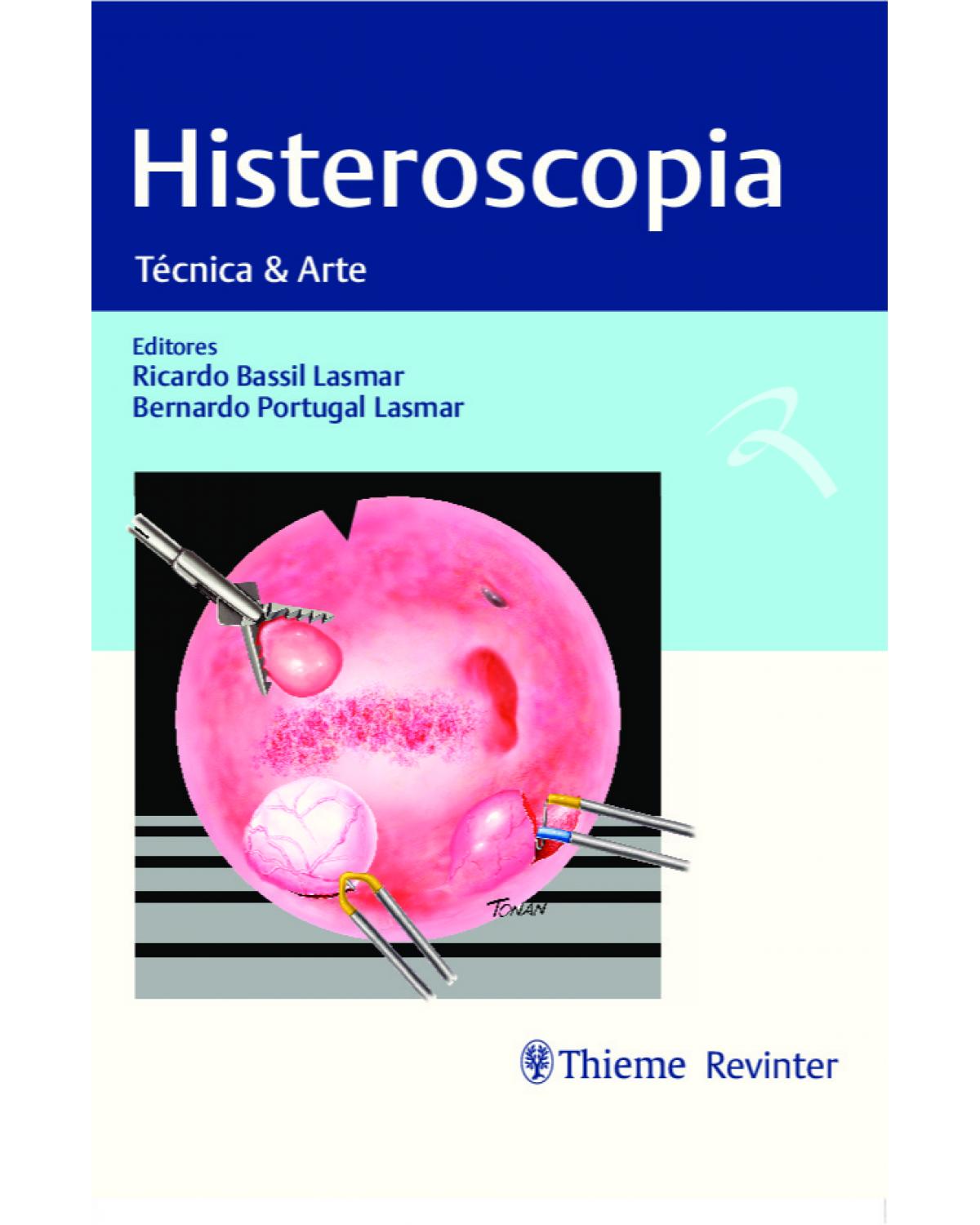 Histeroscopia - técnica e arte - 1ª Edição | 2021