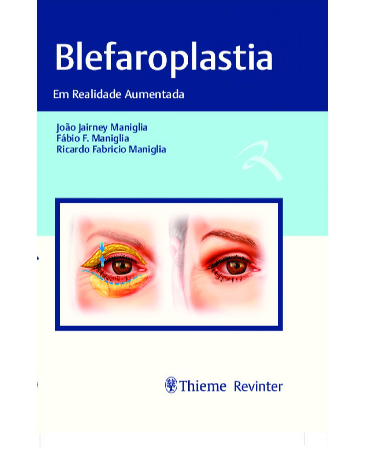 Blefaroplastia - em realidade aumentada - 1ª Edição | 2021