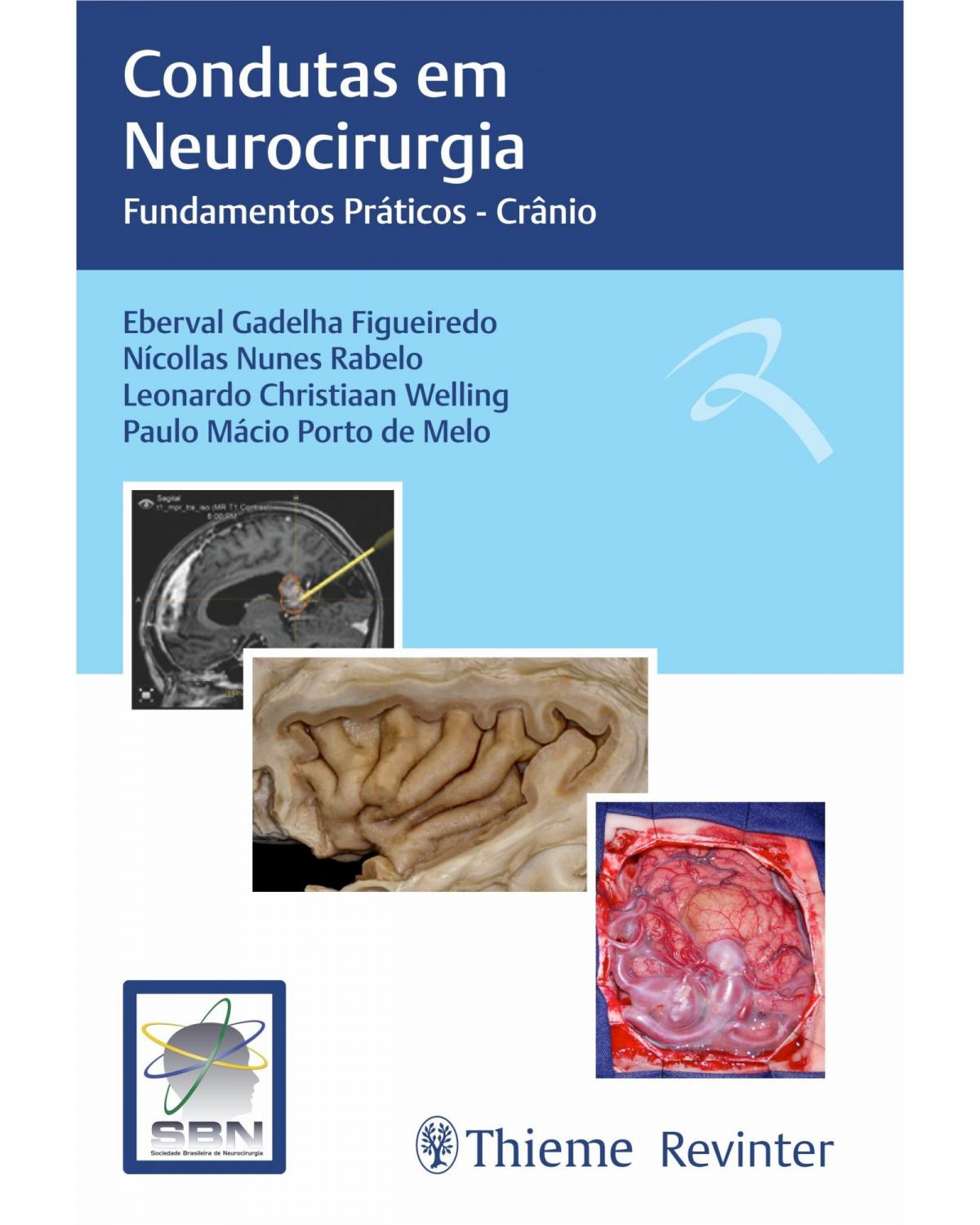 Condutas em Neurocirurgia - Fundamentos Práticos - Crânio - 1ª Edição | 2022