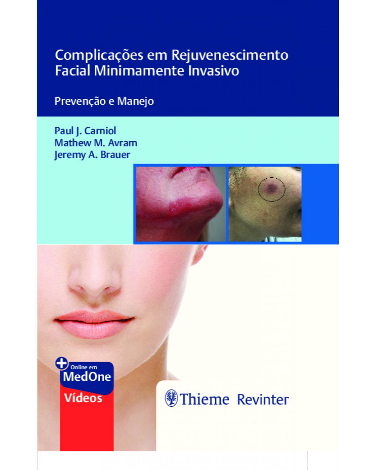 Complicações em rejuvenescimento facial minimamente invasivo - prevenção e manejo - 1ª Edição | 2022