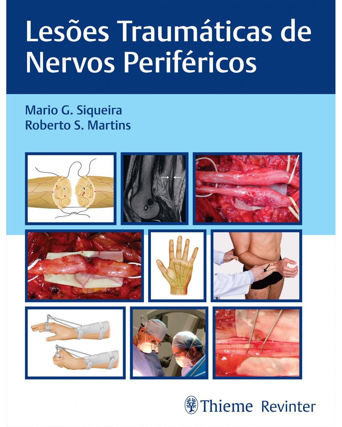 Lesões traumáticas de nervos periféricos - 1ª Edição | 2022