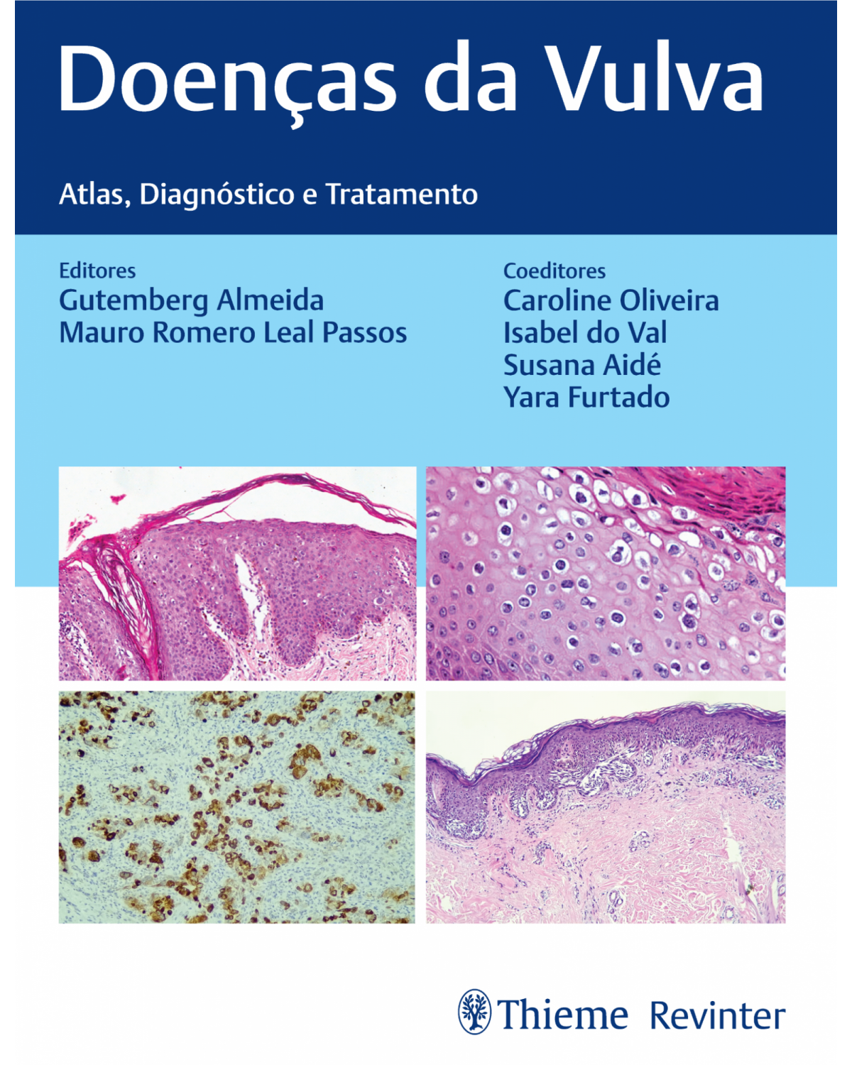 Doenças da vulva - atlas, diagnóstico e tratamento - 1ª Edição | 2022