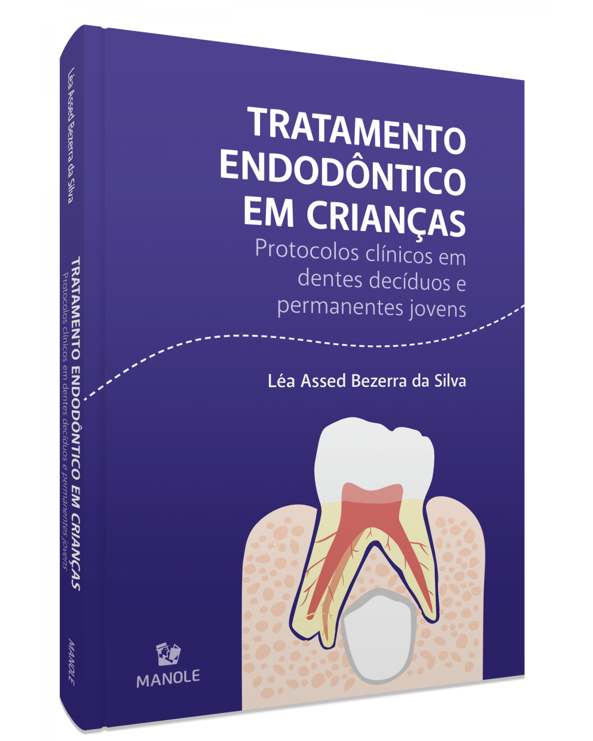 Tratamento endodôntico em crianças - protocolos clínicos em dentes decíduos e permanentes jovens - 1ª Edição | 2021