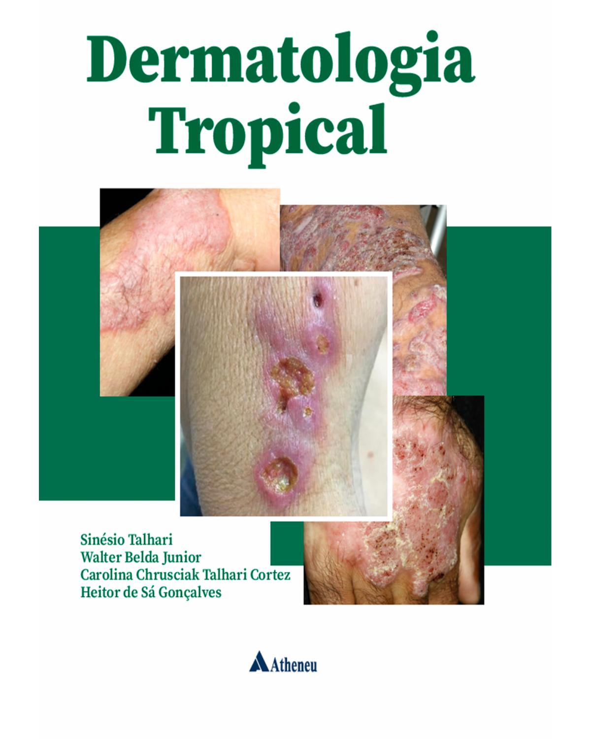 Dermatologia tropical - 1ª Edição | 2022