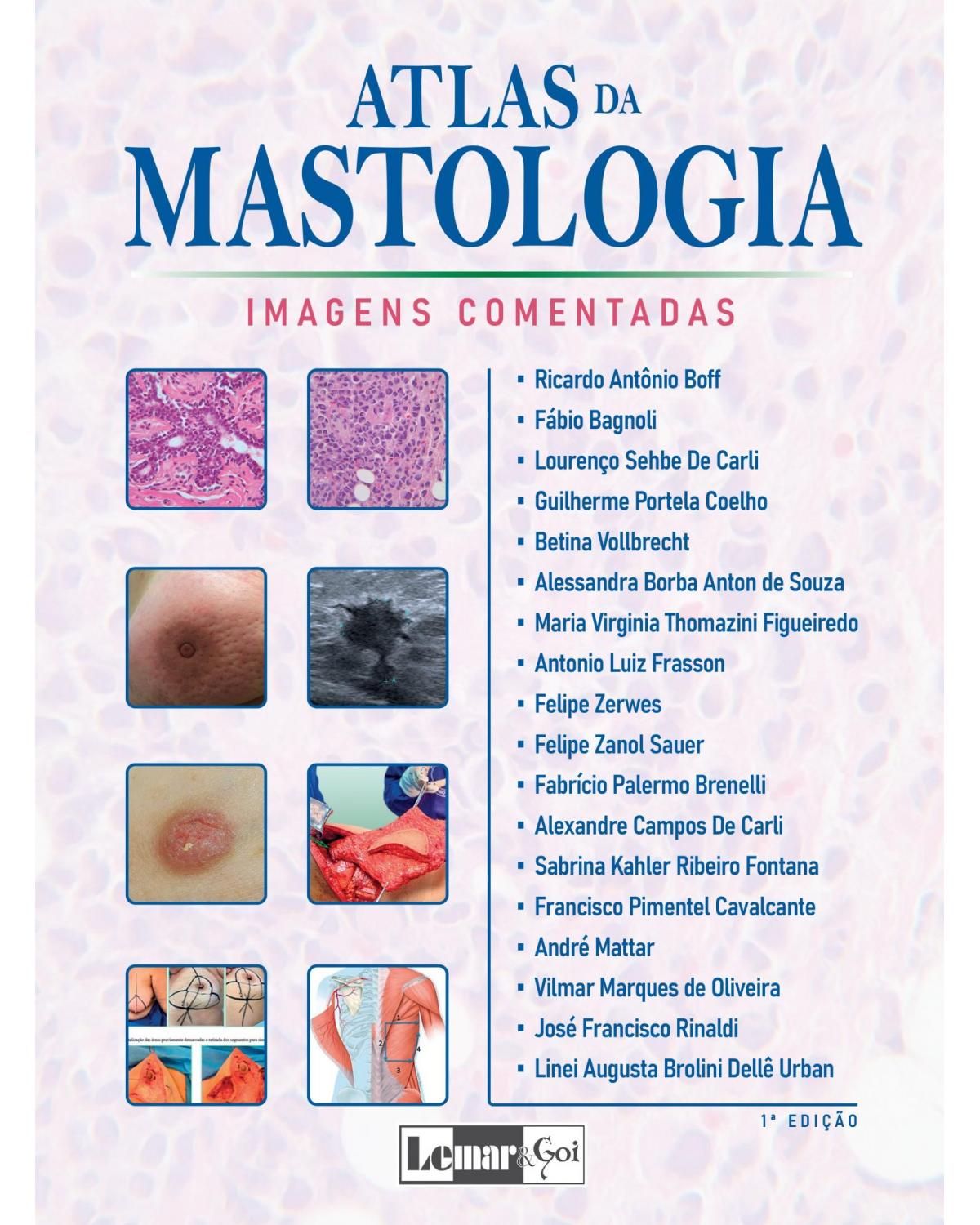 Atlas da mastologia - Volume 1: imagens comentadas - 1ª Edição | 2021