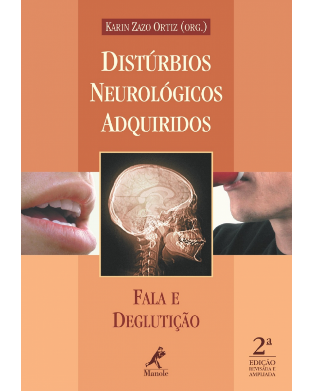 Distúrbios neurológicos adquiridos - Fala e deglutição - 2ª Edição | 2009
