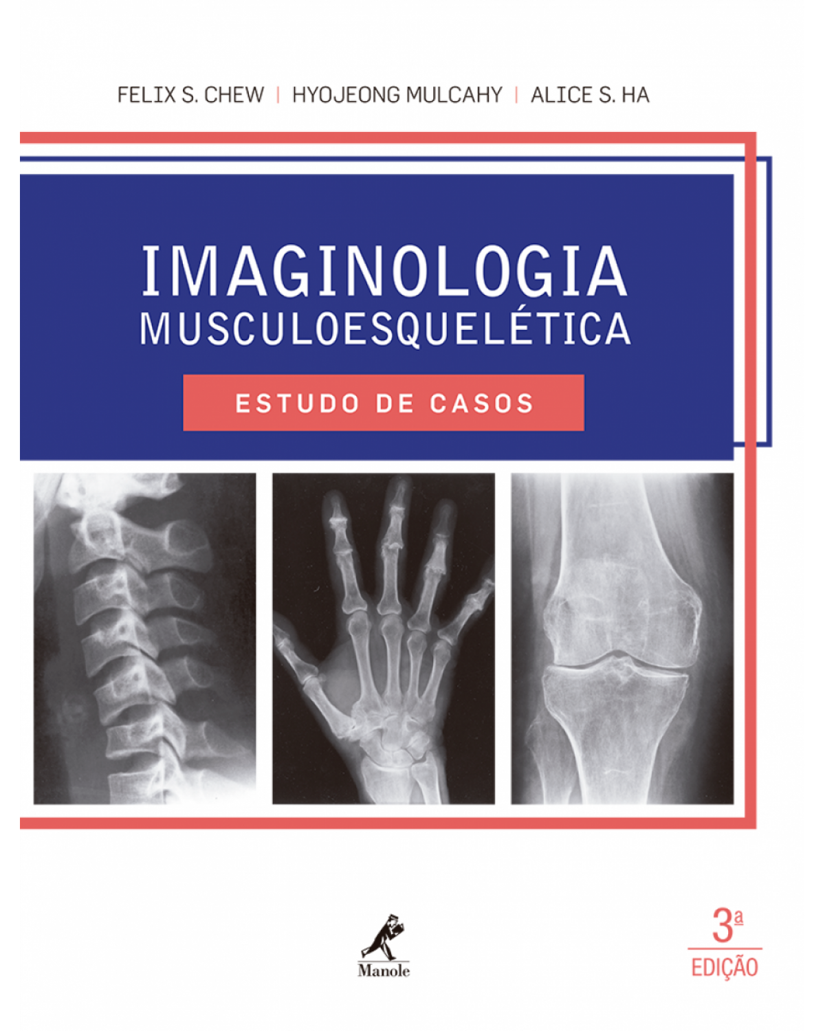 Imaginologia musculoesquelética - Estudo de casos - 3ª Edição | 2016