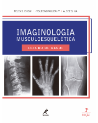 Imaginologia musculoesquelética - Estudo de casos - 3ª Edição | 2016