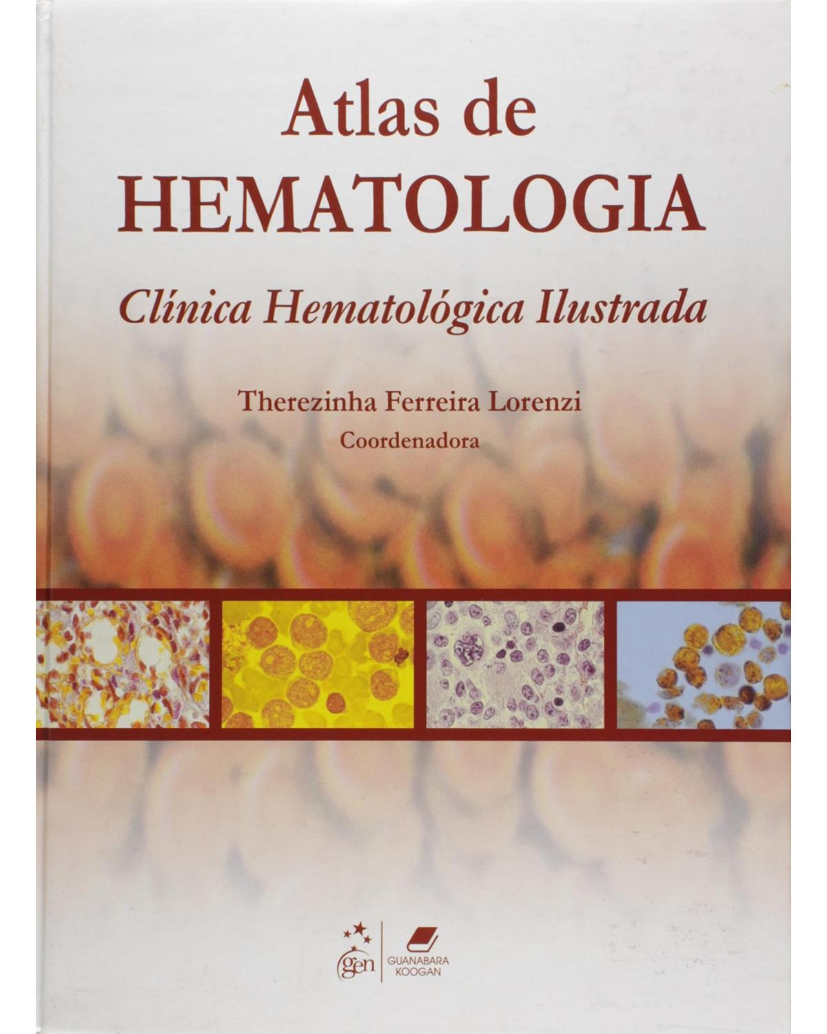 Atlas de hematologia: Clínica hematológica ilustrada - 1ª Edição | 2006