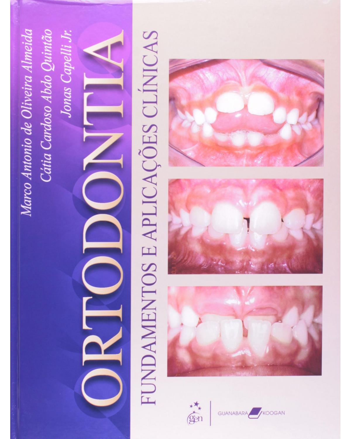 Ortodontia - Fundamentos e aplicações clínicas - 1ª Edição | 2008