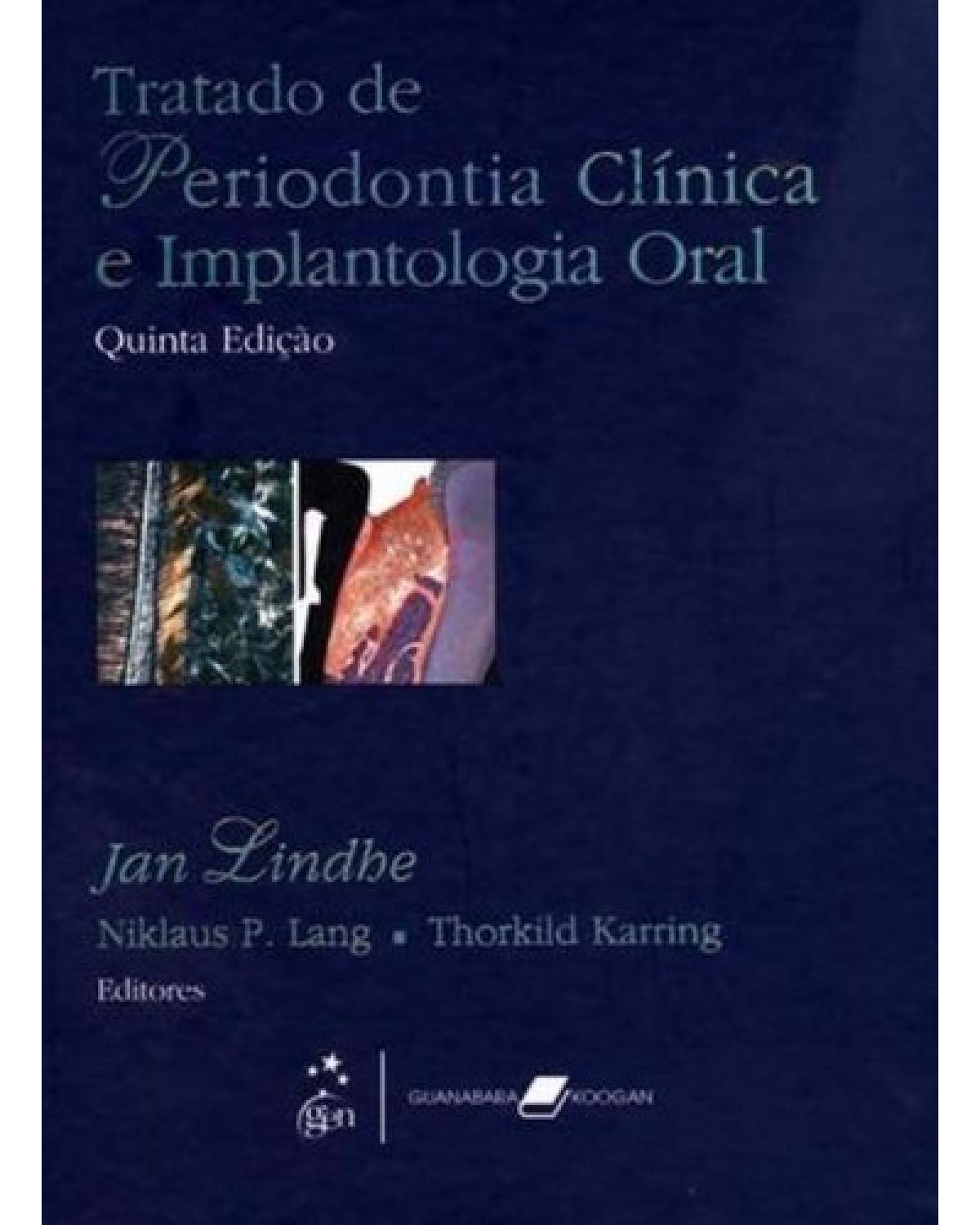 Tratado de periodontia clínica e implantologia oral - 5ª Edição | 2010