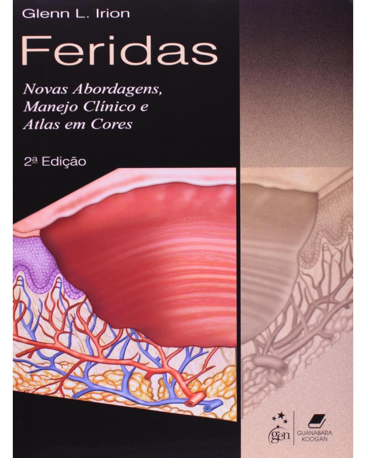 Feridas - Novas abordagens, manejo clínico e atlas em cores - 2ª Edição | 2012