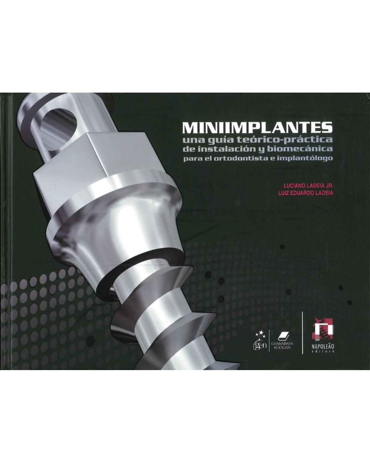 Miniimplantes - una guía teórico-práctica de instalación y biomecánica para el ortodontista e implantólogo - 1ª Edição | 2012