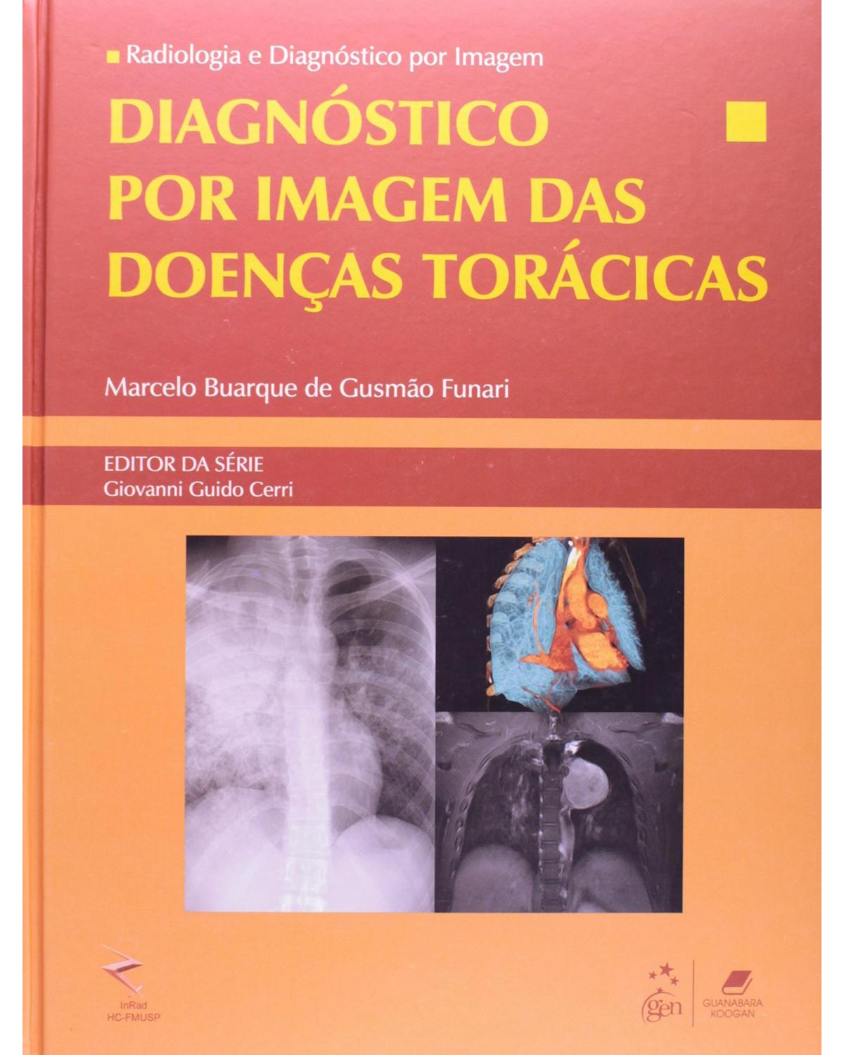 Diagnóstico por imagem das doenças torácicas - 1ª Edição | 2012