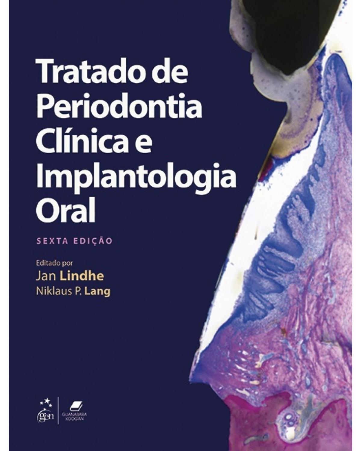 Tratado de periodontia clínica e implantologia oral - 6ª Edição | 2018