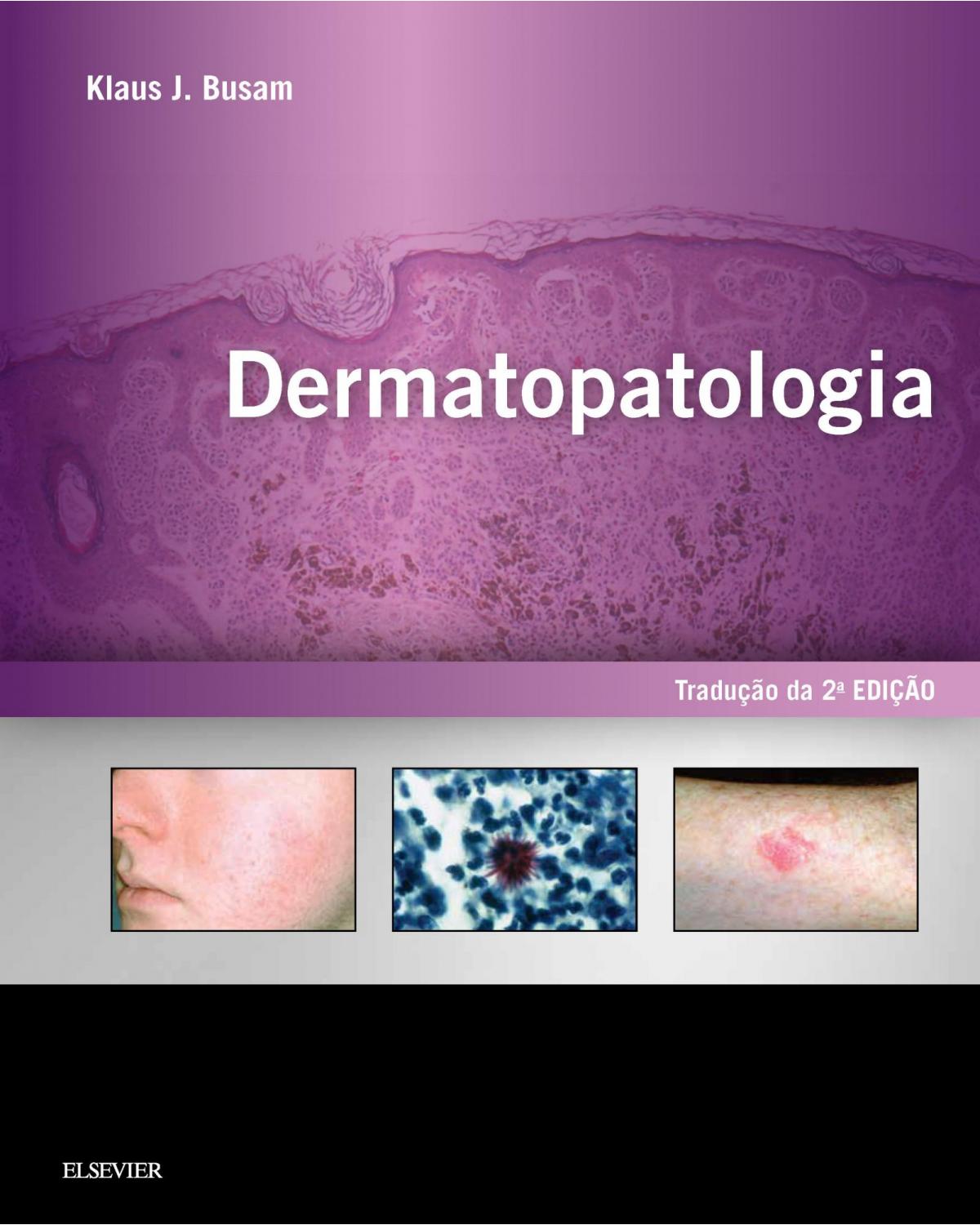 Dermatopatologia - 2ª Edição | 2019