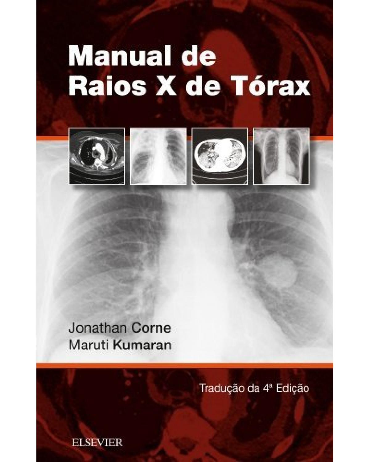Manual de raios-x de tórax - 4ª Edição | 2016