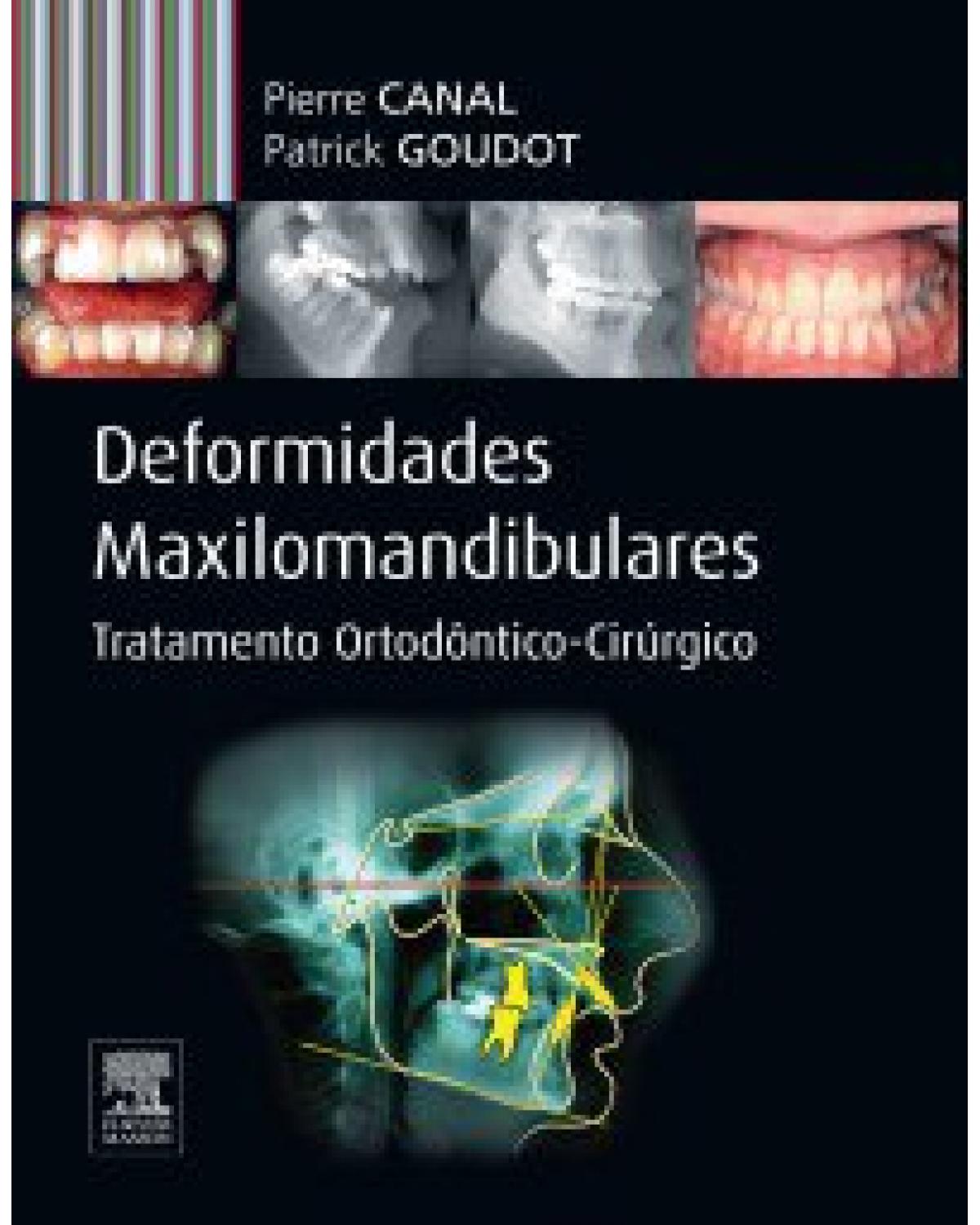 Deformidades maxilomandibulares - tratamento ortodôntico-cirúrgico - 1ª Edição | 2013
