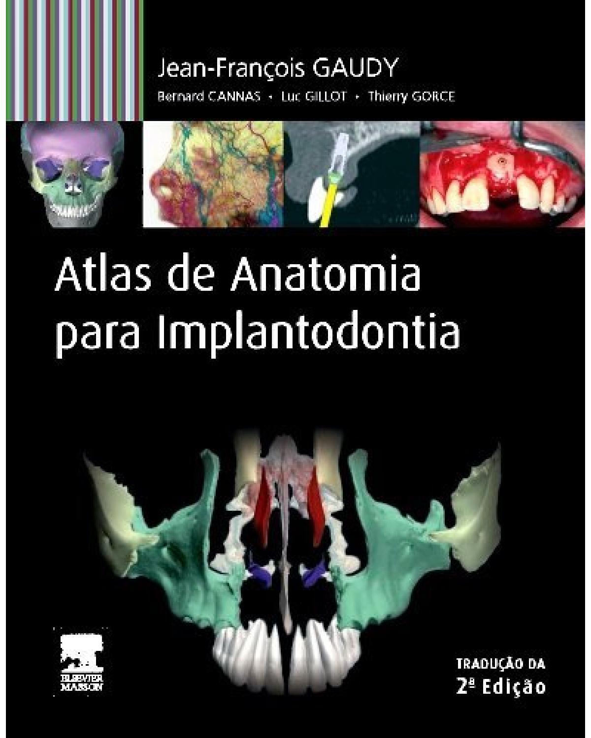 Atlas de anatomia para implantodontia - 1ª Edição | 2014