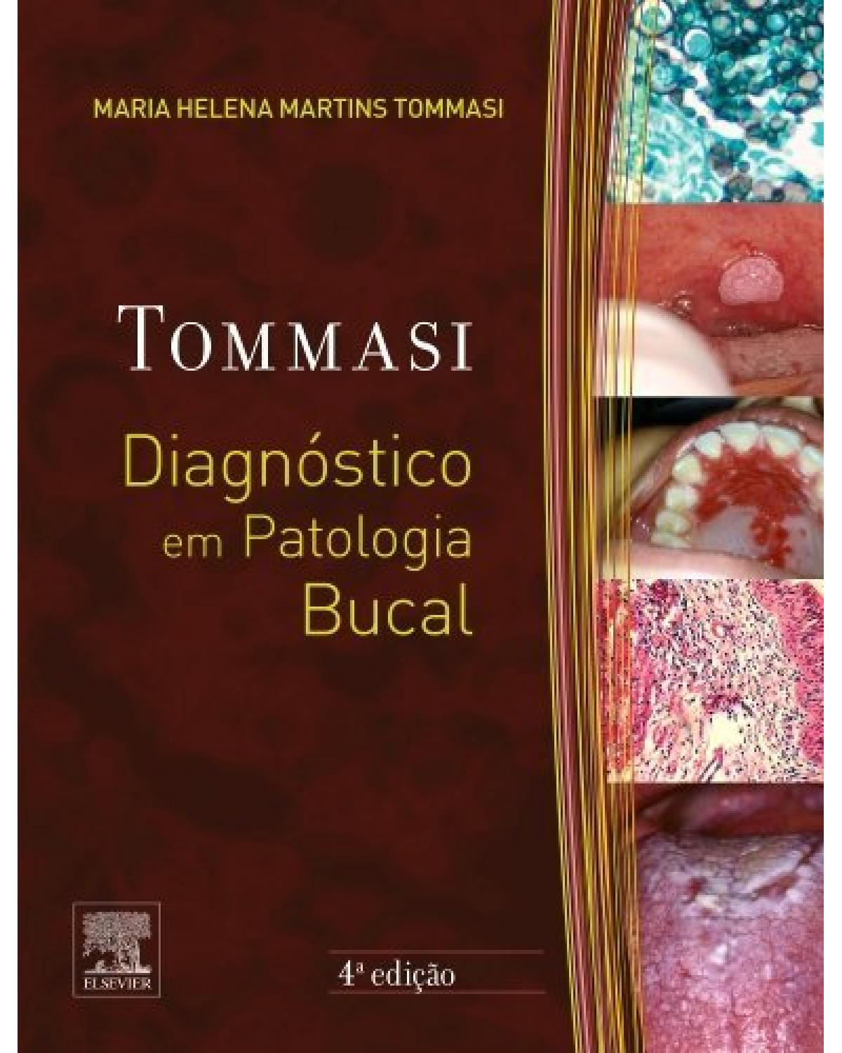 Diagnóstico em patologia bucal - 4ª Edição | 2014