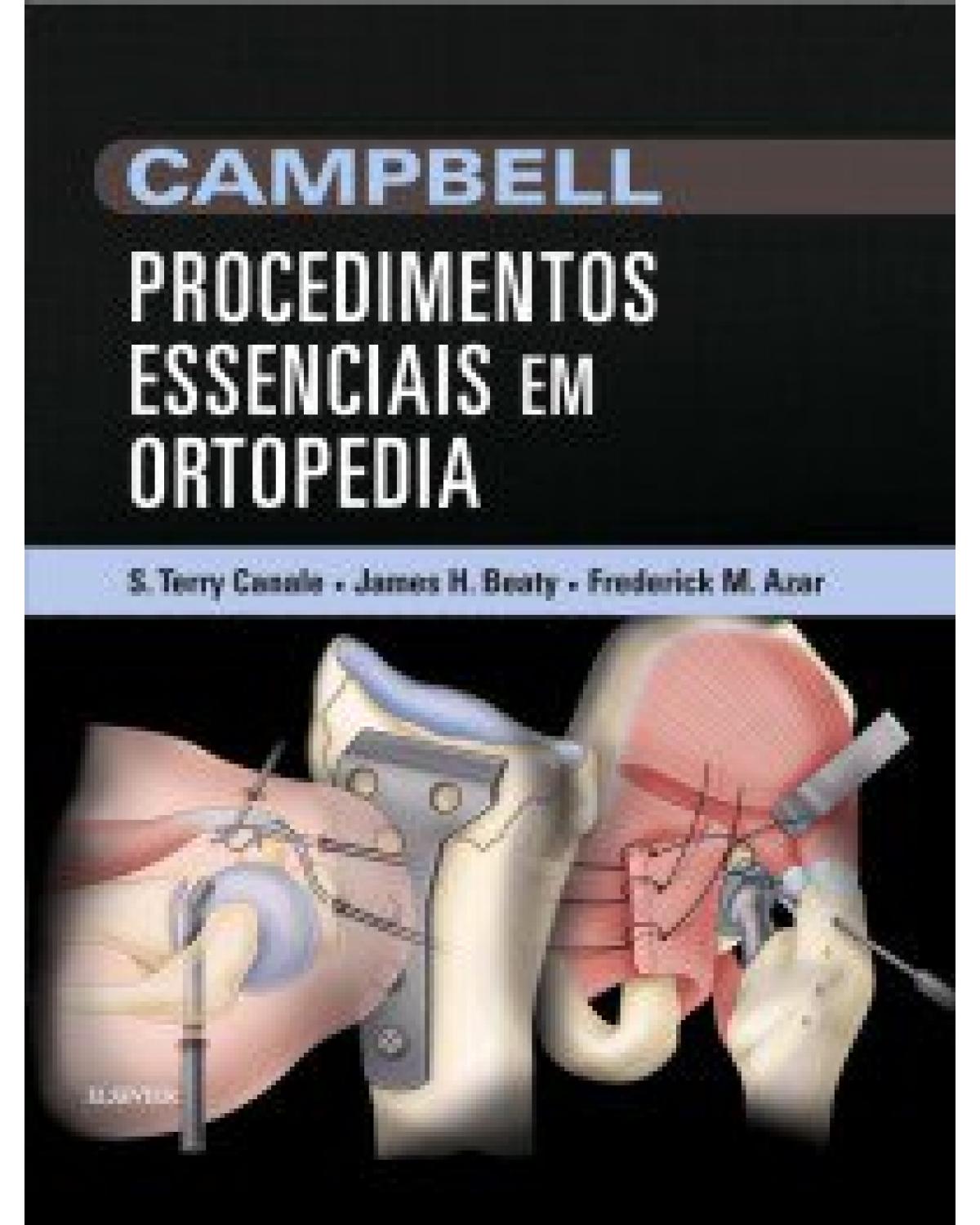 Campbell - Procedimentos essenciais em ortopedia - 1ª Edição | 2017
