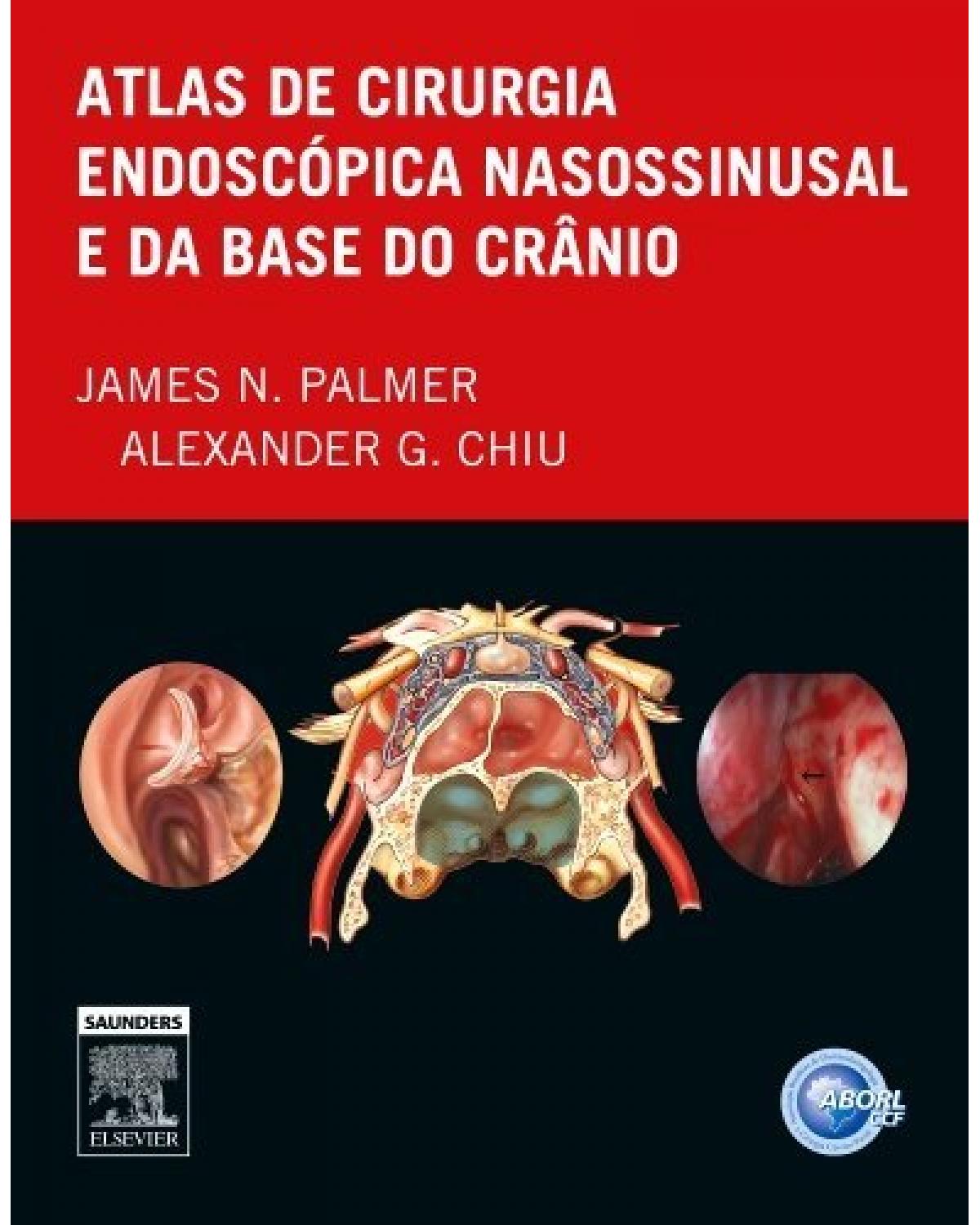 Atlas de cirurgia endoscópica nanossinusal e da base do crânio - 1ª Edição | 2014