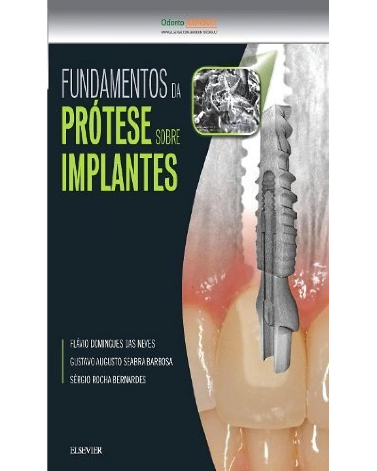 Fundamentos da prótese sobre implantes - 1ª Edição | 2016