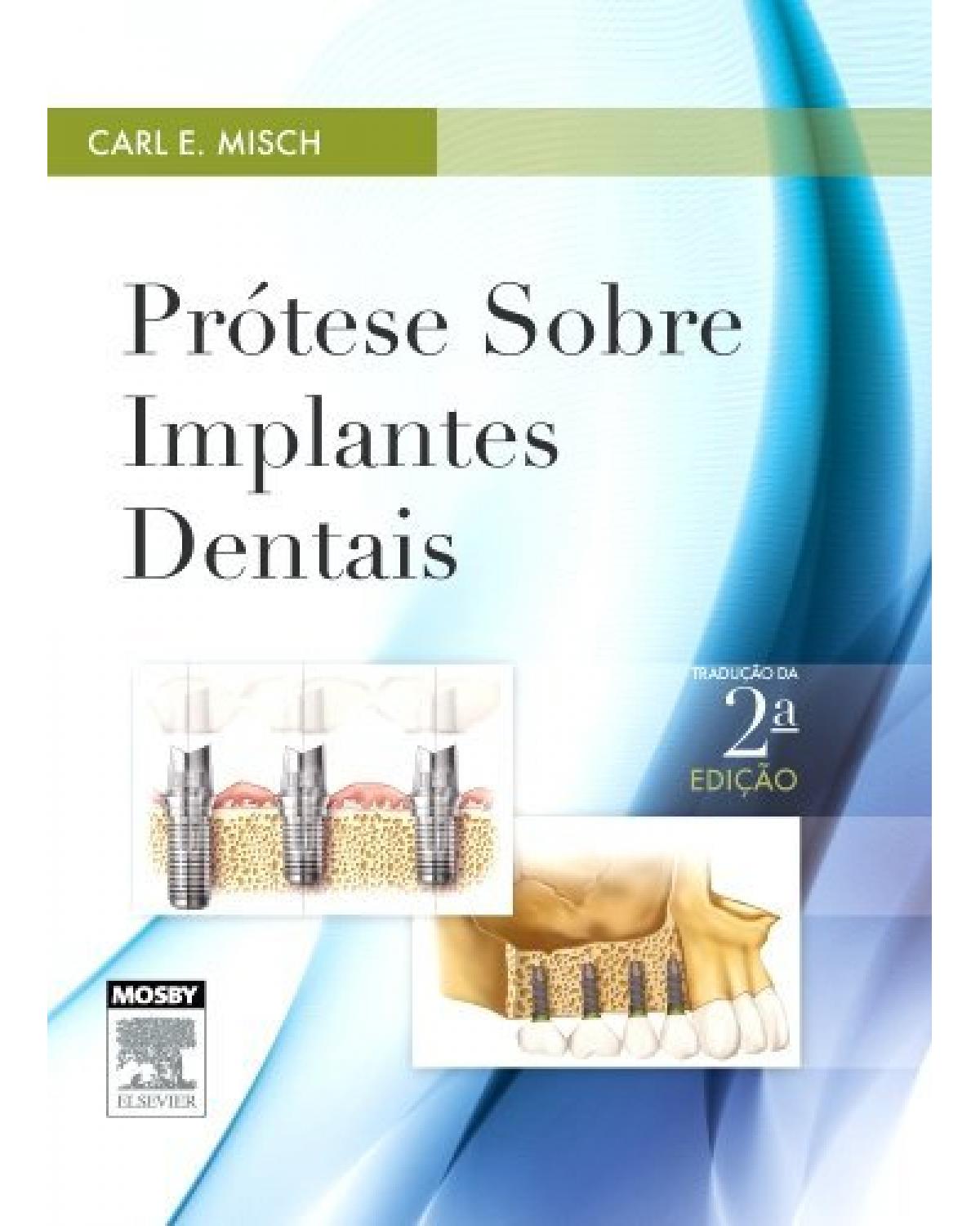 Prótese sobre implantes dentais - 2ª Edição | 2015
