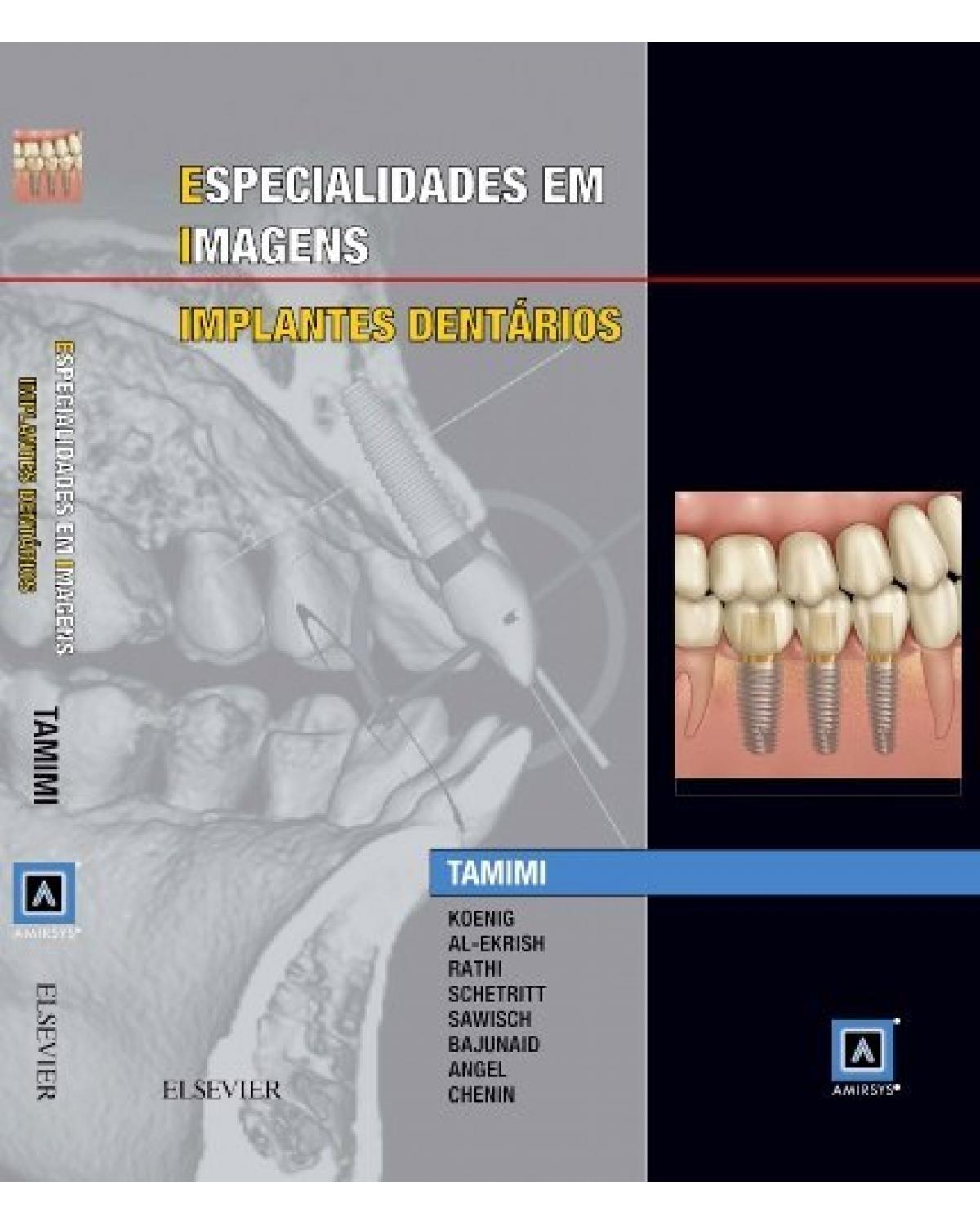 Especialidades em imagens - implantes dentários - 1ª Edição | 2016