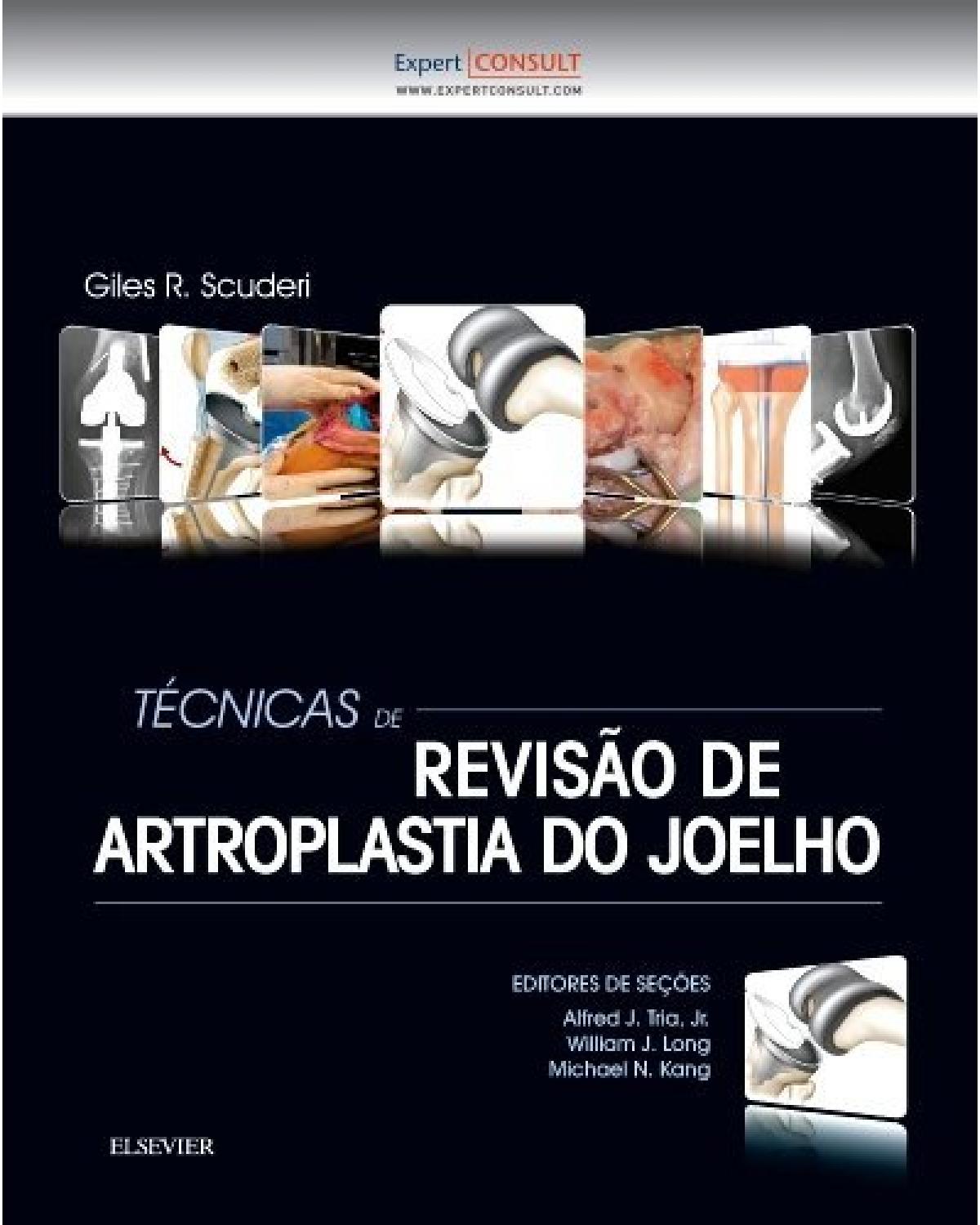 Técnicas de revisão de artroplastia do joelho - 1ª Edição | 2016