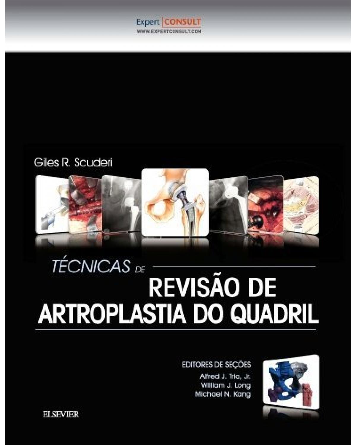 Técnicas de revisão de artroplastia do quadril - 1ª Edição | 2016