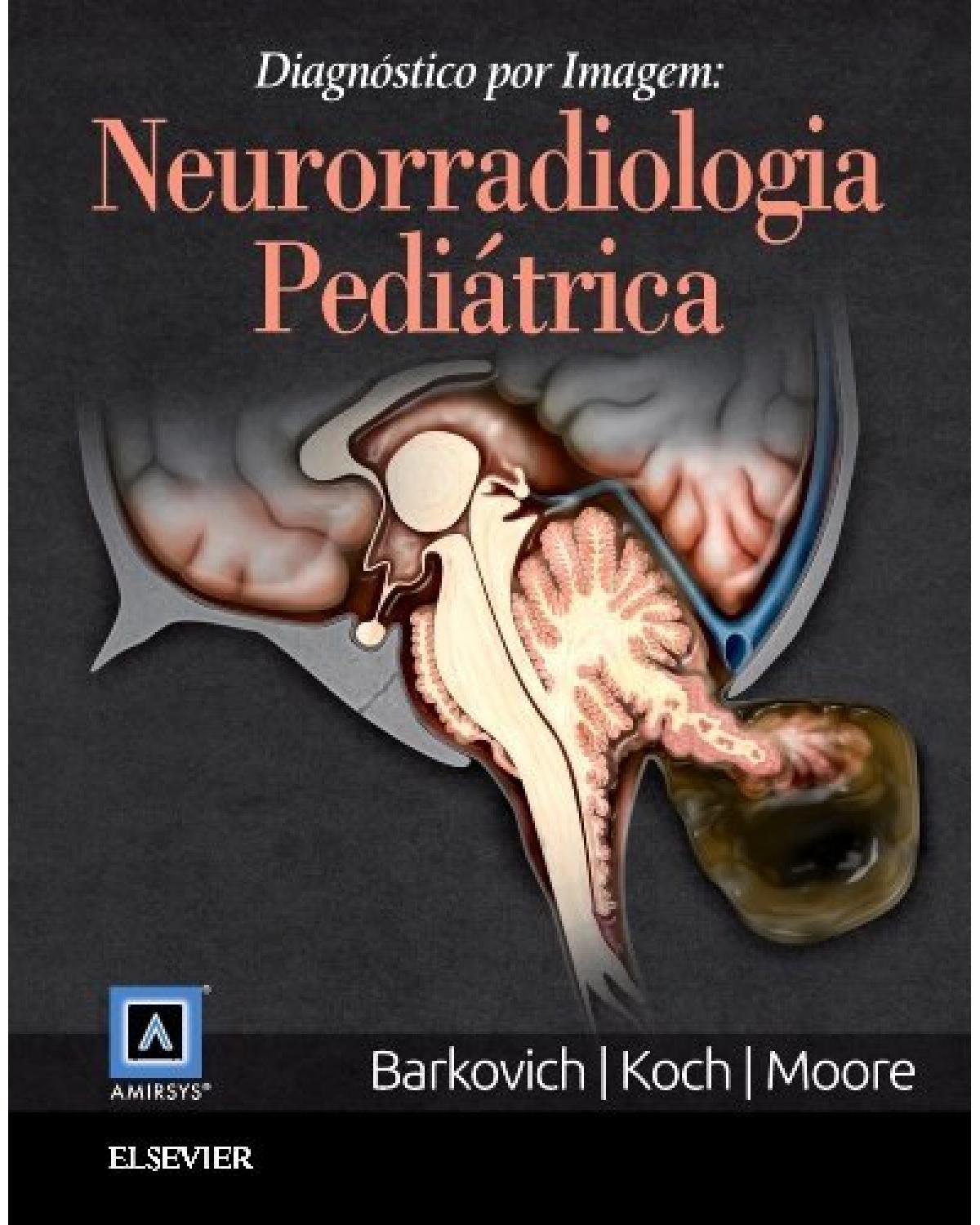 Diagnóstico por imagem: neurorradiologia pediátrica - 2ª Edição | 2016
