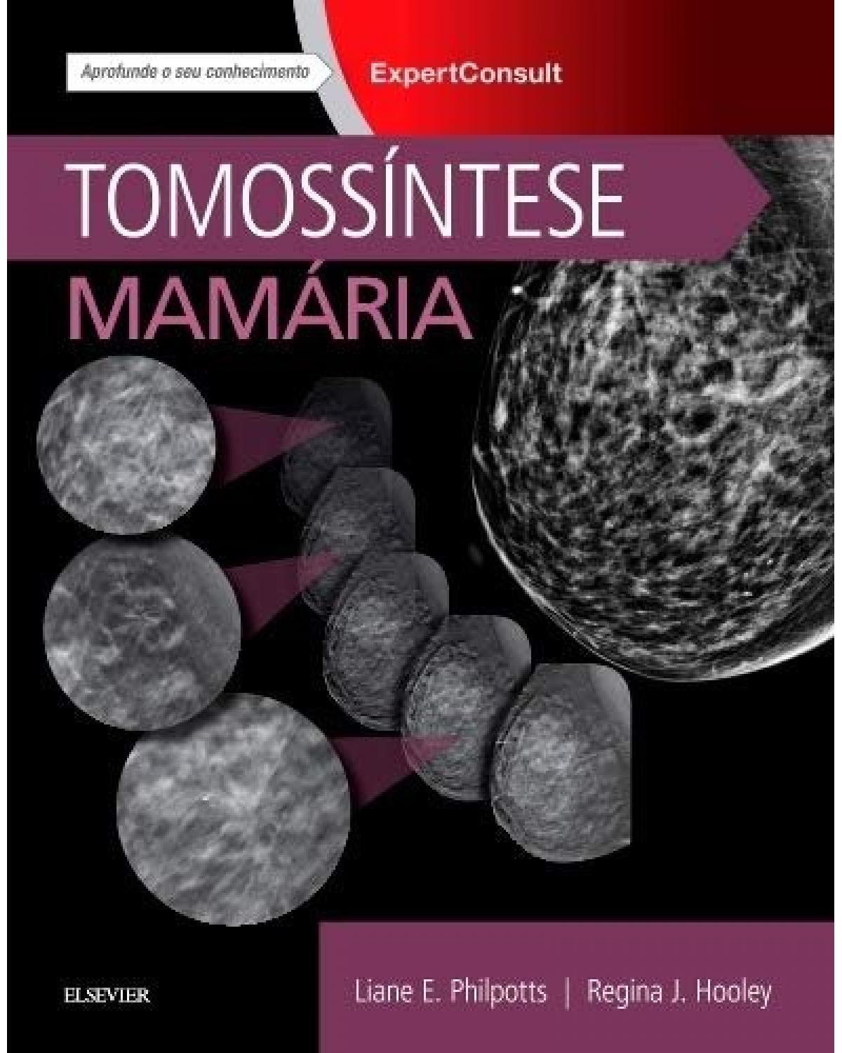 Tomossíntese mamária - 1ª Edição | 2018