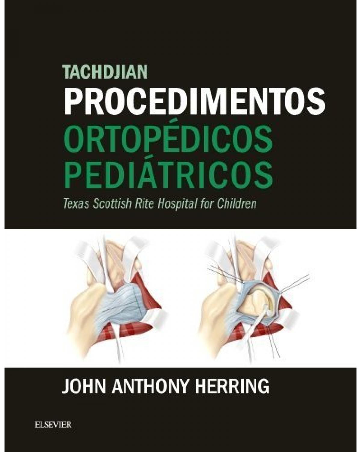 Tachdjian - Procedimentos ortopédicos pediátricos - 1ª Edição | 2017
