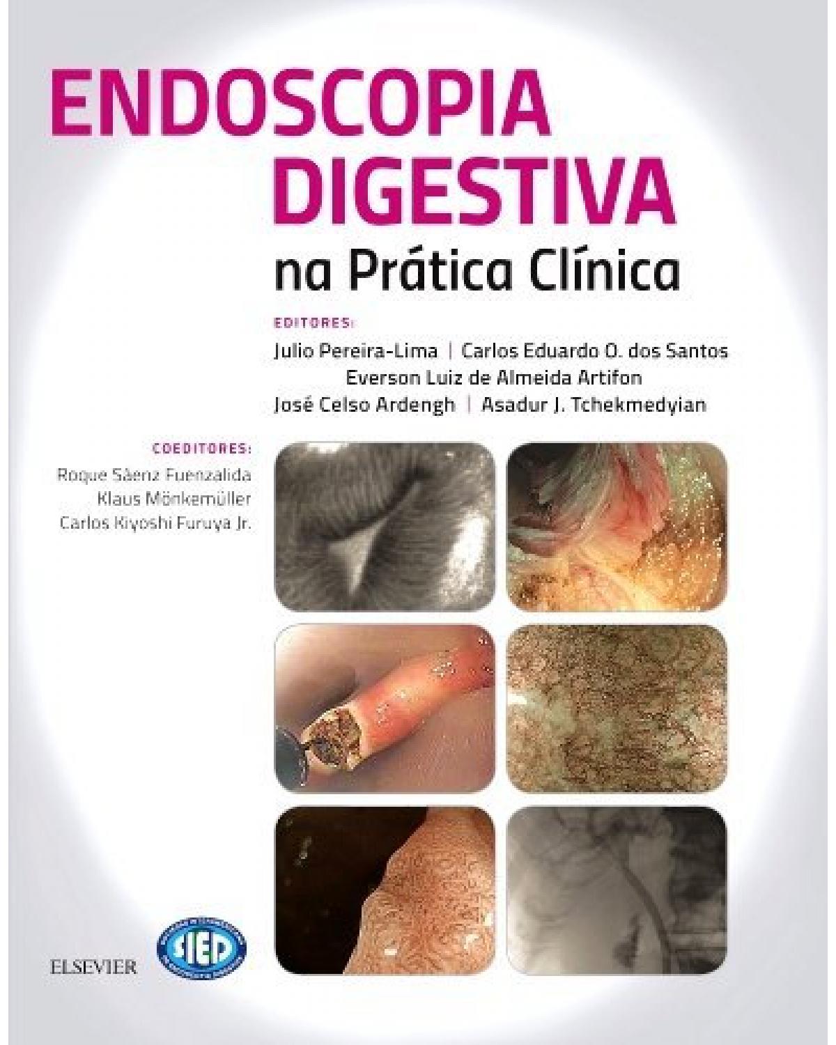 Endoscopia digestiva na prática clínica - 1ª Edição | 2018