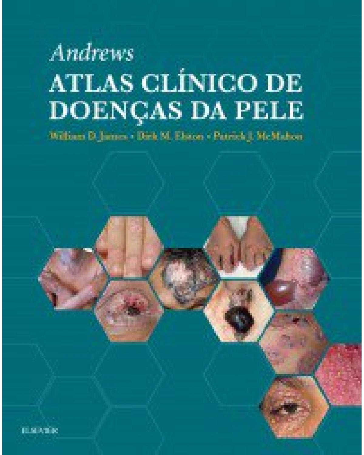 Andrew - Atlas clínico de doenças da pele - 1ª Edição | 2018