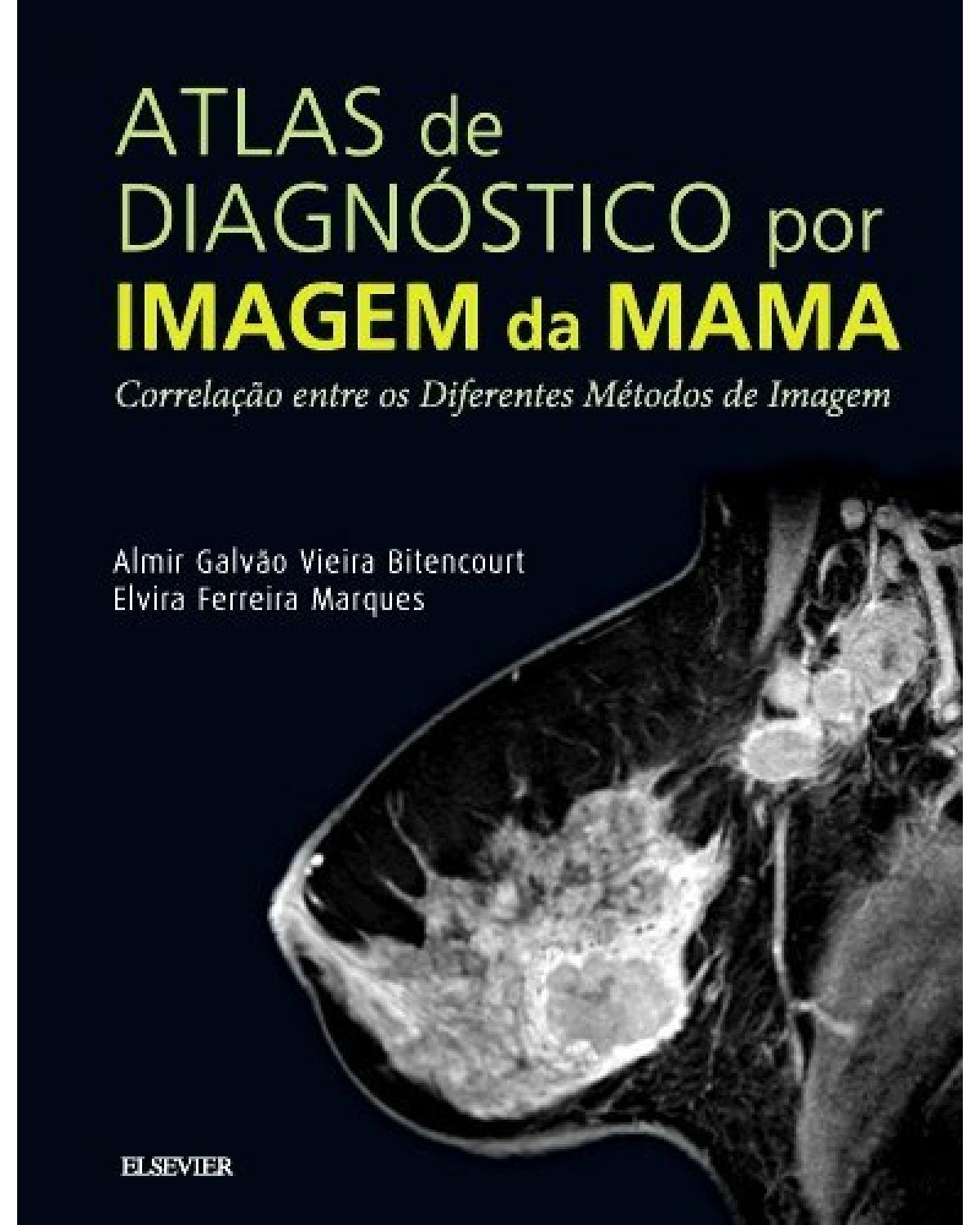 Atlas de diagnóstico por imagem da mama - 1ª Edição | 2018